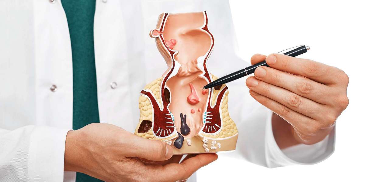 Is Laser Piles Treatment Better Than Traditional Surgery?