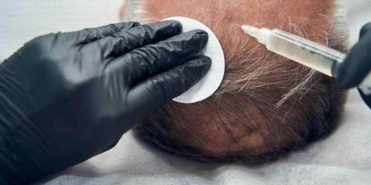 Exosome Hair in Dubai for Men: Real Results Shared