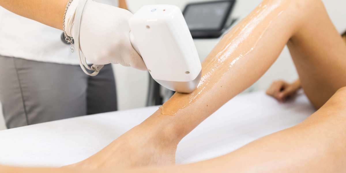 Laser Hair Removal Bold Beauty Upgrade Feel Fresh Every Moment