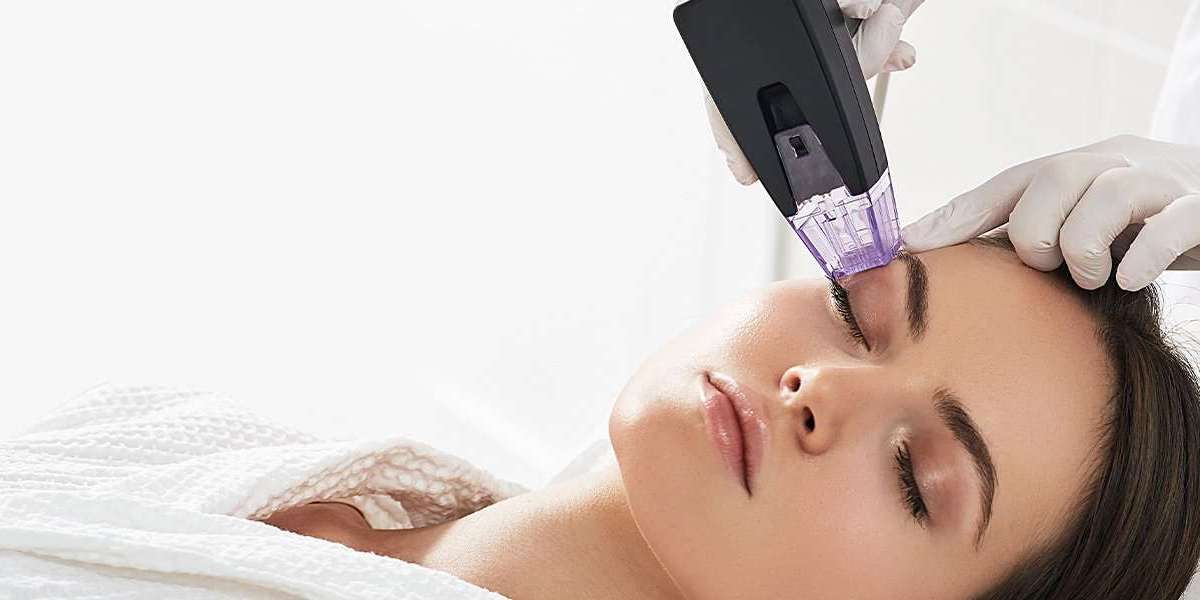 Non-Surgical Facelift with Morpheus8 in Dubai