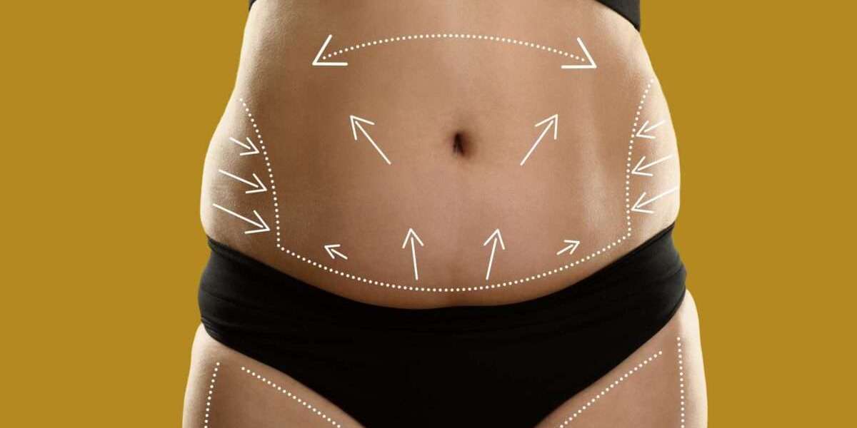 Liposuction Benefits Beyond Fat Removal