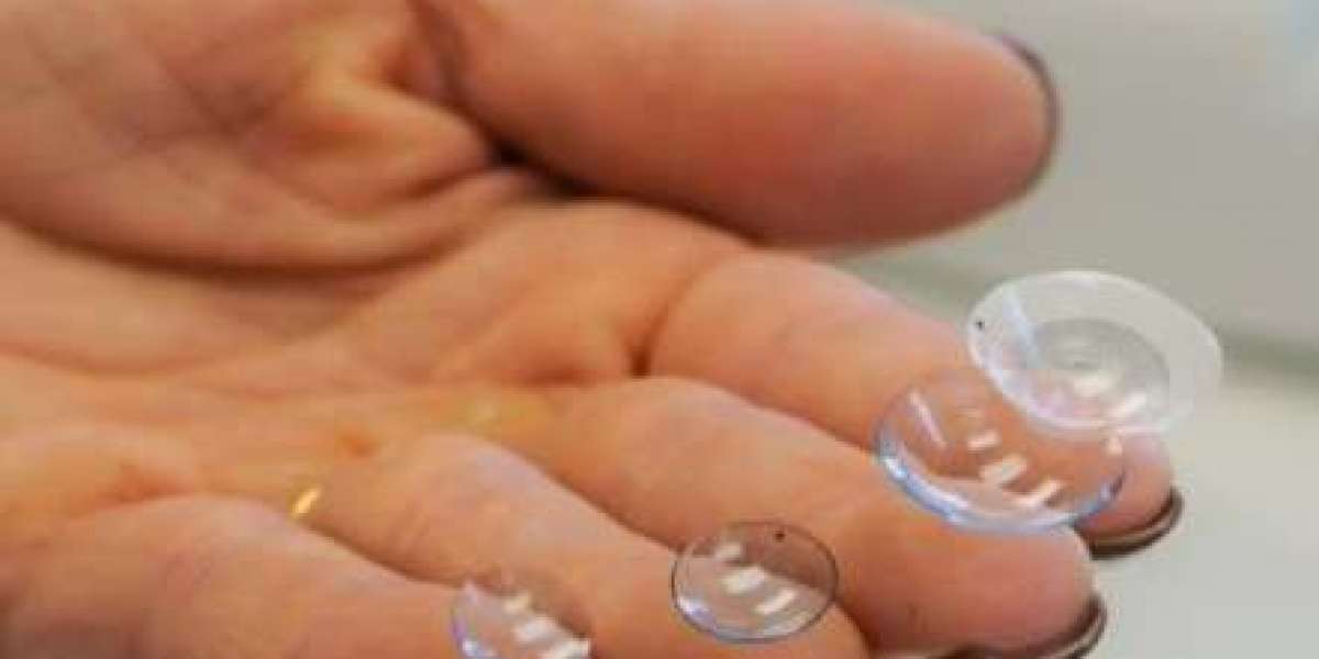Custom Scleral Lenses Charlotte for Clear Vision