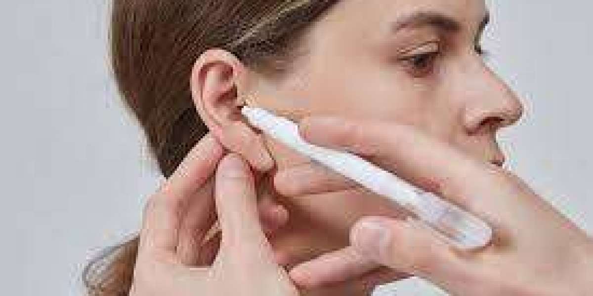 How natural do results of Otoplasty look?