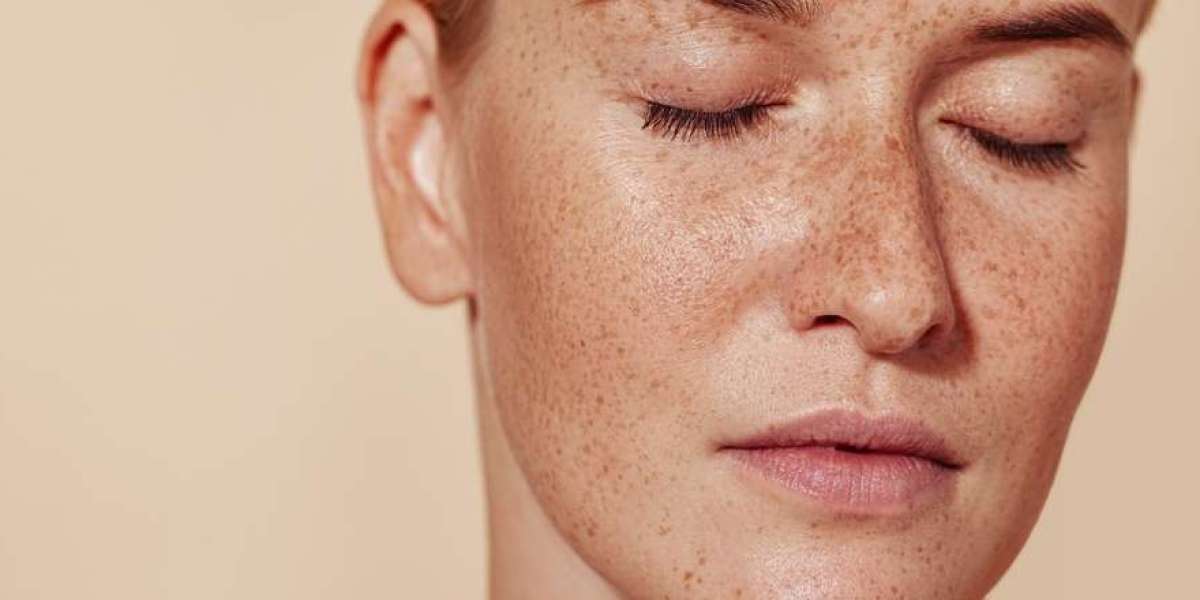 Top Benefits of Choosing Pigmentation Treatment in Dubai