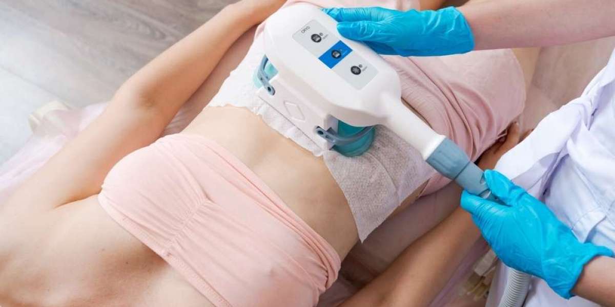 7 Reasons to Choose Fat Freeze Treatment for Body Shaping
