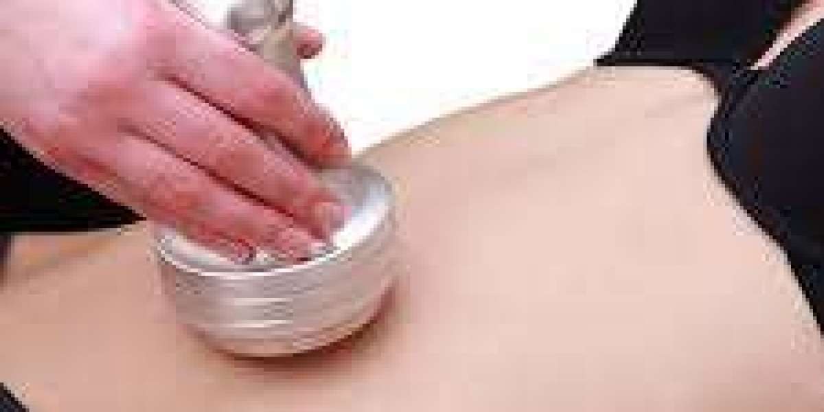 How Liposuction Surgery in Dubai Helps Achieve a More Defined Body Shape