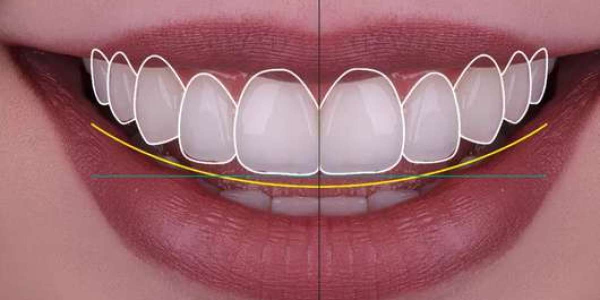 How To Design the Perfect Simple Smile in India