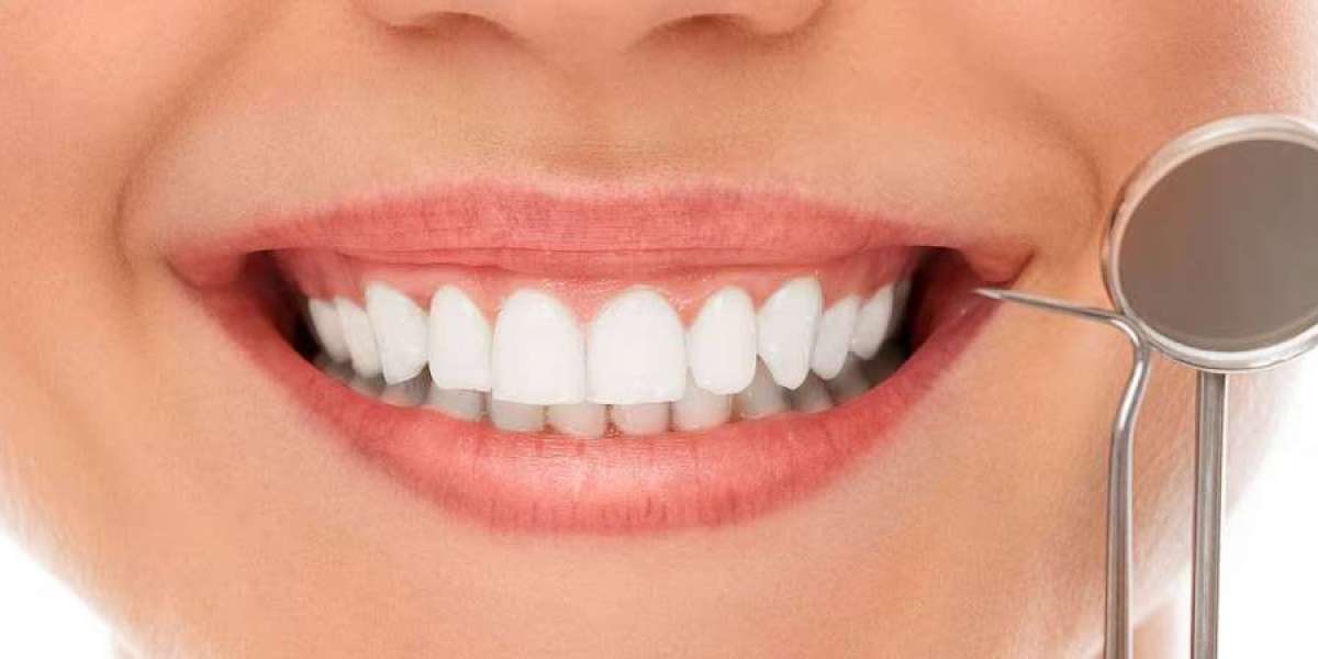 Top Cosmetic Dental Treatments to Transform Your Smile