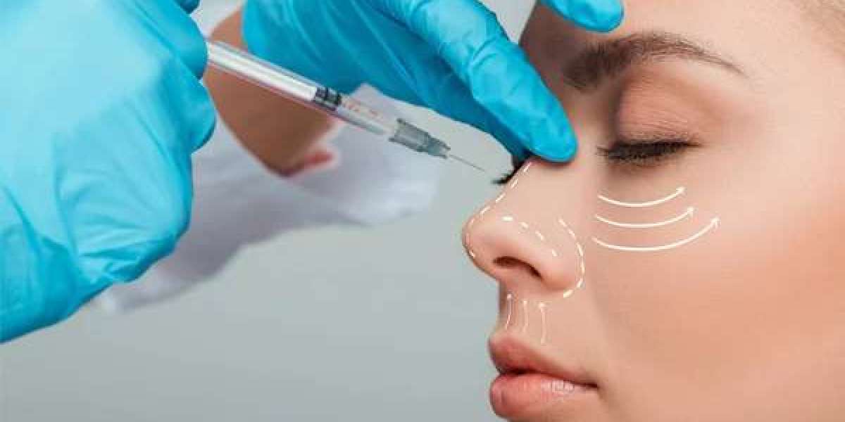 What Are the Benefits of Botox Injection in Islamabad?
