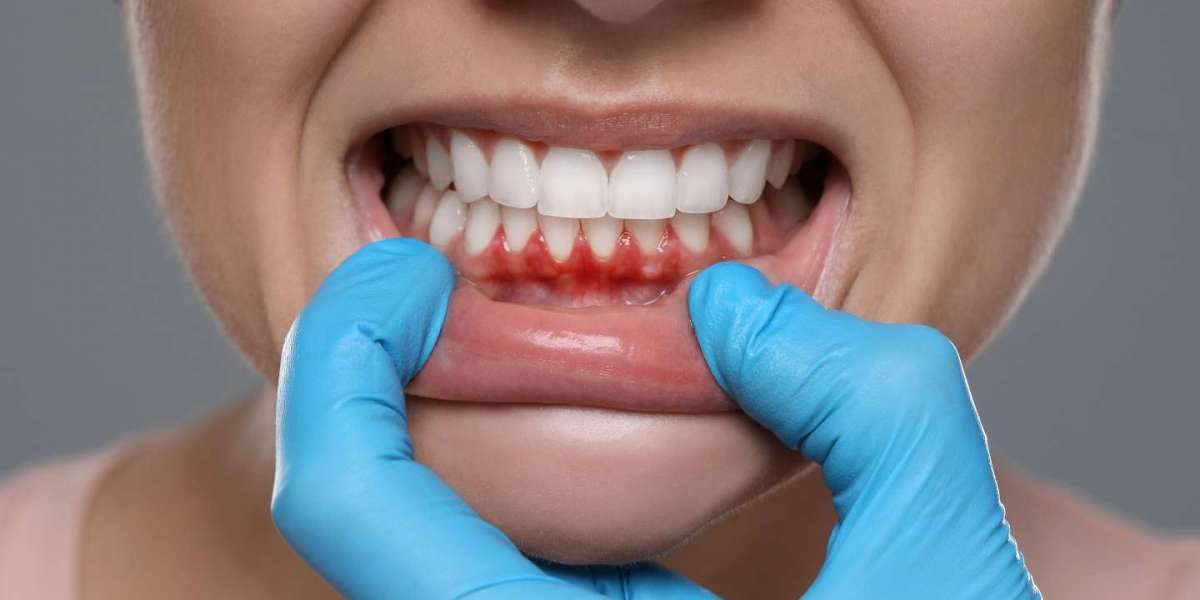 How Professional Gum Disease Treatment Can Save Your Teeth