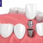 Pediatric Dentistry Blueprint