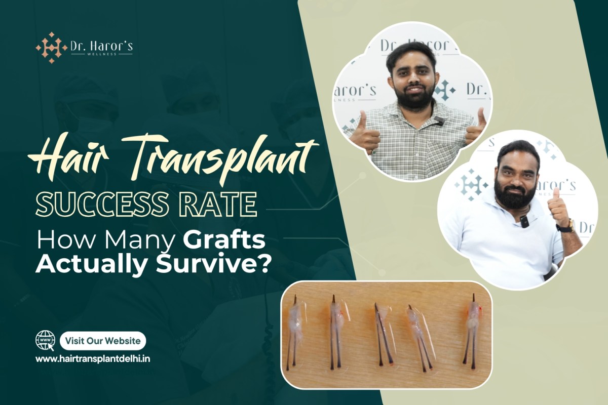 Hair Transplant Success Rate: How Many Grafts Actually Survive? – hairtransplantclinicinidia