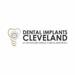 Dental Implants Cleveland